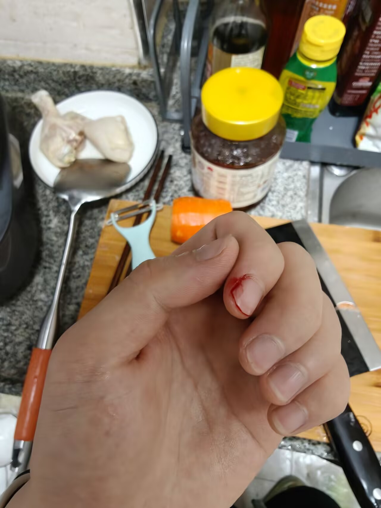 切到手了